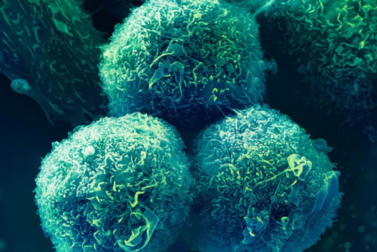 Oncología